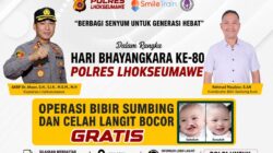 Besok, Polres Lhokseumawe Gelar Operasi Bibir Sumbing Gratis untuk Masyarakat dalam Rangka HUT Bhayangkara ke-80