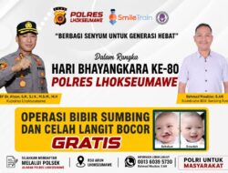 Besok, Polres Lhokseumawe Gelar Operasi Bibir Sumbing Gratis untuk Masyarakat dalam Rangka HUT Bhayangkara ke-80