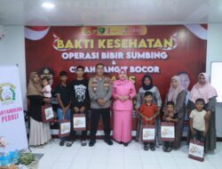 Kapolres Lhokseumawe Resmi Buka Operasi Bibir Sumbing Gratis, 22 Pasien Dapat Harapan Baru di HUT Bhayangkara ke-80